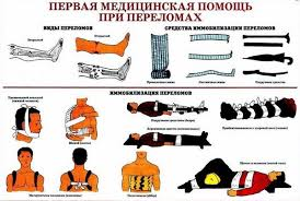 Первая помощь и лечение при вывихе суставов в Москве